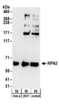 Detection of human RPN2 by western blot.