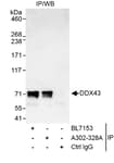 Detection of human DDX43 by western blot of immunoprecipitates.