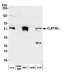 Detection of human CLPTM1L by western blot.