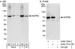 Detection of human and mouse NOP56 by western blot (h&amp;m) and immunoprecipitation (h).