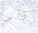 Detection of human NP95/UHRF1 by immunohistochemistry.