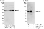 Detection of human ETV3 by western blot and immunoprecipitation.