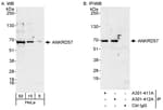 Detection of human ANKRD57 by western blot and immunoprecipitation.