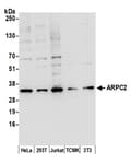 Detection of human and mouse ARPC2 by western blot.