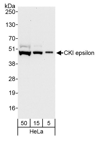 Detection of human CKI epsilon by western blot.