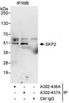 Detection of human SKP2 by western blot of immunoprecipitates.