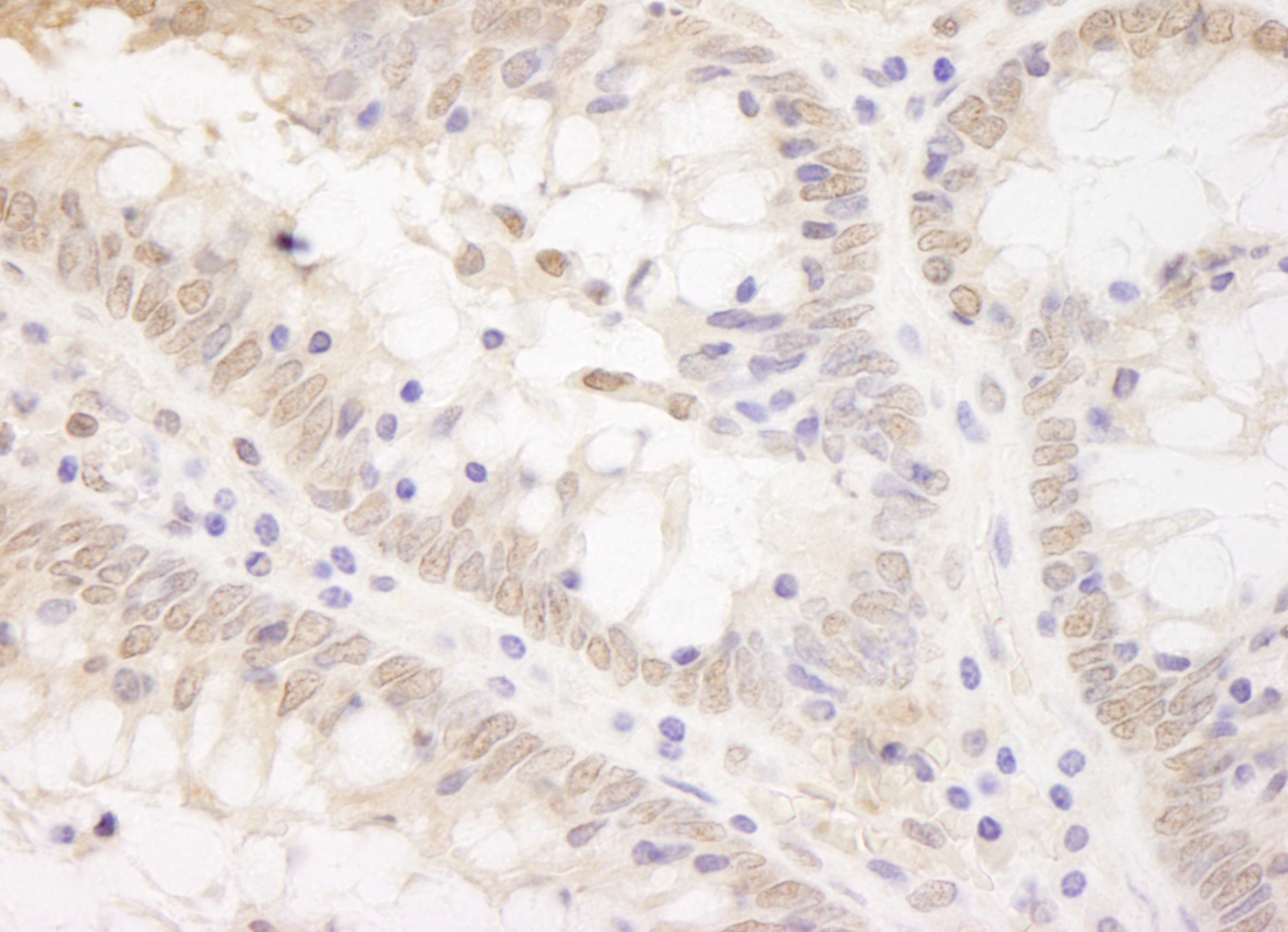 Rabbit anti-TCF12 IHC Antibody