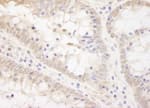 Detection of human TCF12 by immunohistochemistry.
