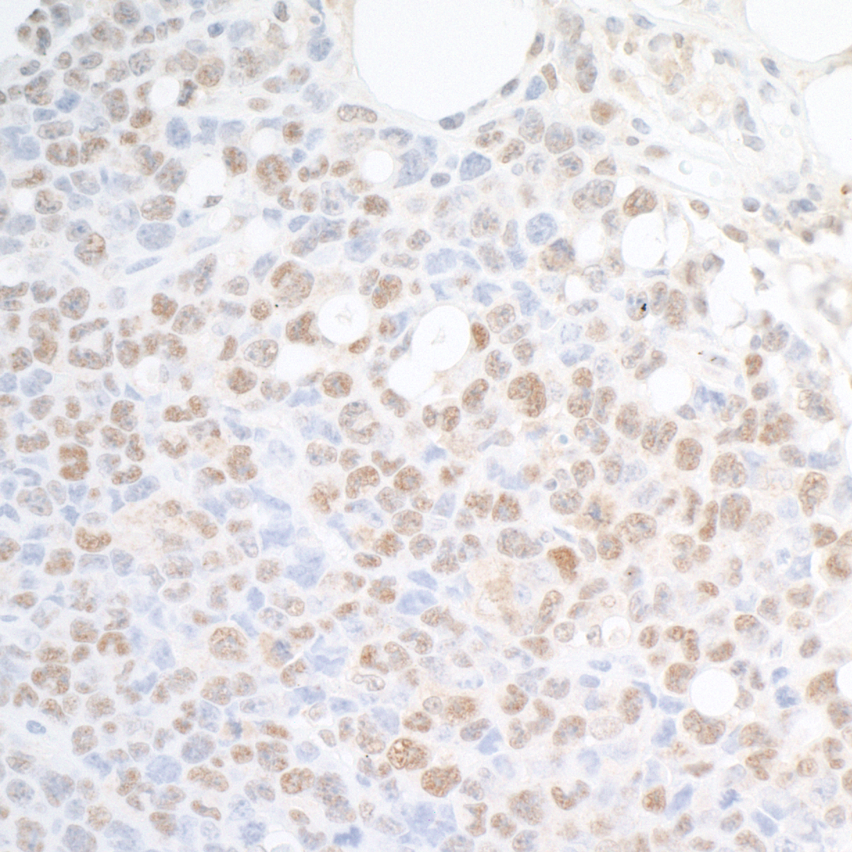 Detection of mouse SUPT6H by immunohistochemistry.
