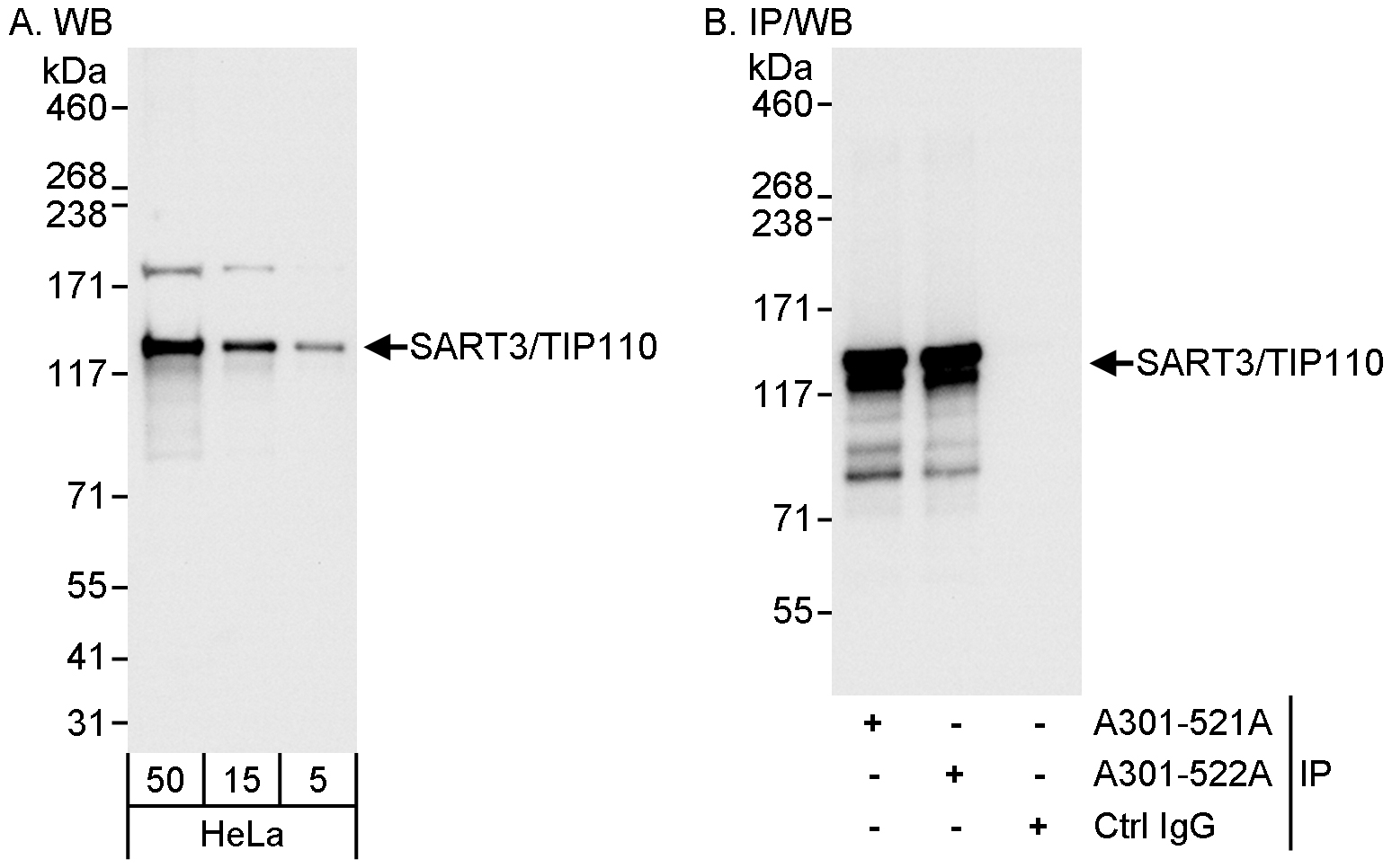 Detection of human SART3/TIP110 by western blot and immunoprecipitation.