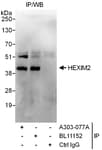 Detection of human HEXIM2 by western blot of immunoprecipitates.