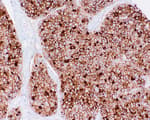 Detection of human CD73 by immunohistochemistry.