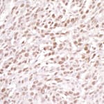 Detection of mouse DDB1 by immunohistochemistry.