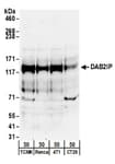 Detection of mouse DAB2IP by western blot.