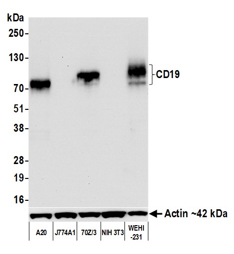 Rabbit anti-CD19 Recombinant Monoclonal Antibody [BLR208K]