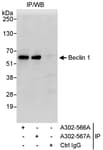 Detection of human Beclin 1 by western blot of immunoprecipitates.