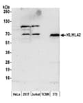 Detection of human and mouse KLHL42 by western blot.