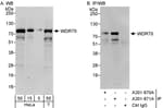 Detection of human WDR70 by western blot and immunoprecipitation.