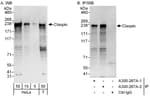 Detection of human Claspin by western blot and immunoprecipitation.