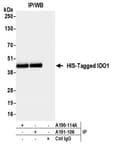 Detection of HIS-Tagged protein by western blot of immunoprecipitates.