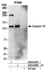 Detection of human Calpain-15 by western blot of immunoprecipitates.