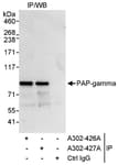 Detection of human PAP-gamma by western blot of immunoprecipitates.