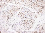Detection of mouse Matrin 3 by immunohistochemistry.