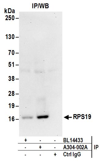 Detection of human RPS19 by western blot of immunoprecipitates.