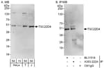 Detection of human TSC22D4 by western blot.