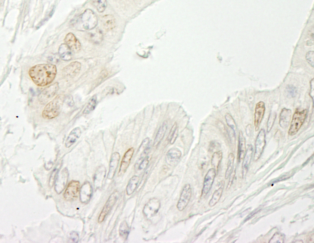 Rabbit anti-RBM10 IHC Antibody