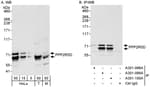 Detection of human and mouse PPP2R5D by western blot (h&amp;m) and immunoprecipitation (h).