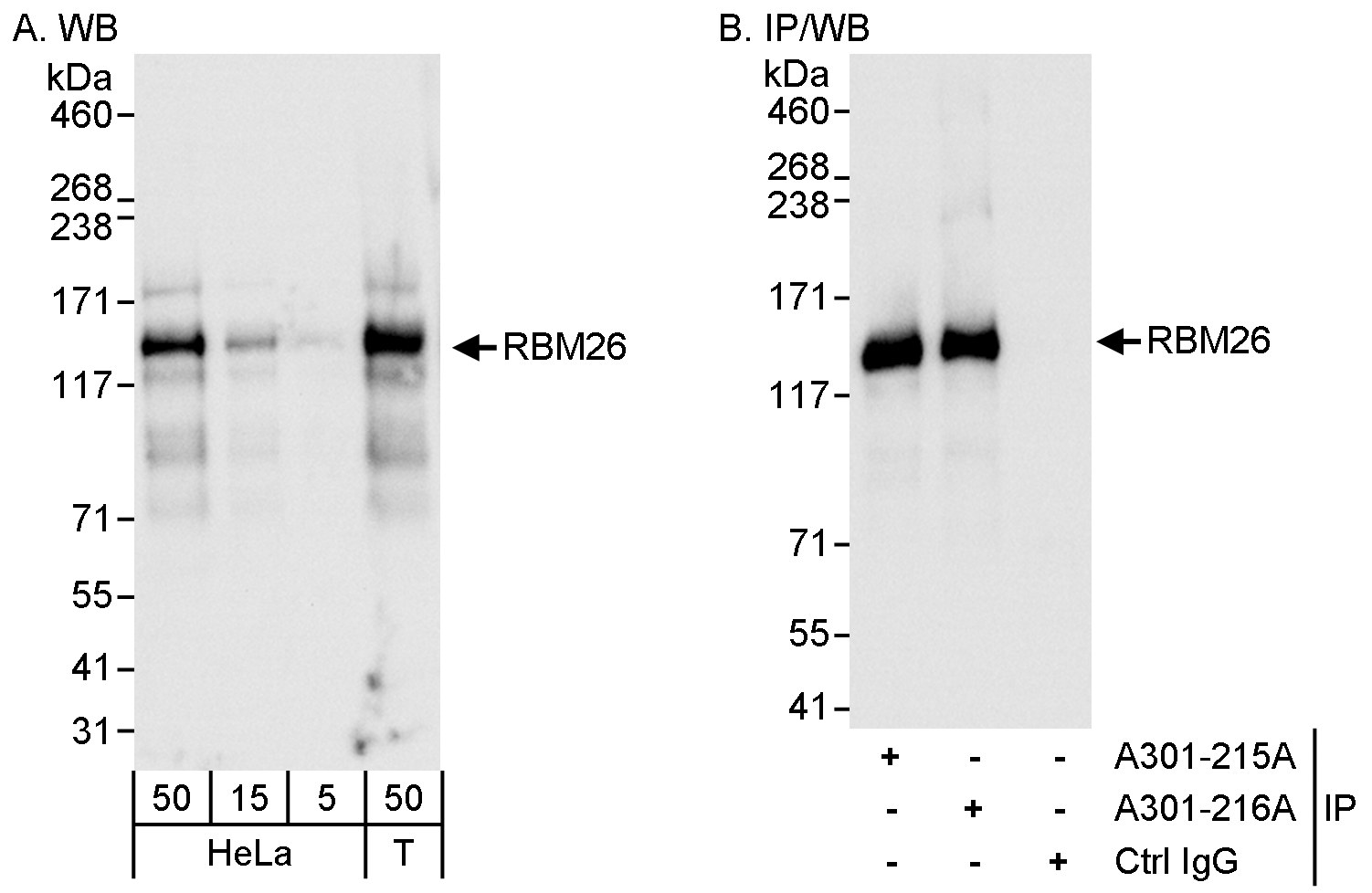 Detection of human RBM26 by western blot and immunoprecipitation.