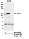 Detection of human PALB2 by western blot of immunoprecipitates.