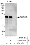 Detection of human CLIP115 by western blot of immunoprecipitates.