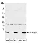 Detection of human S100A16 by western blot.