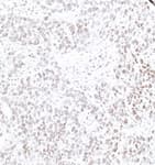 Detection of human IFI16 by immunohistochemistry.