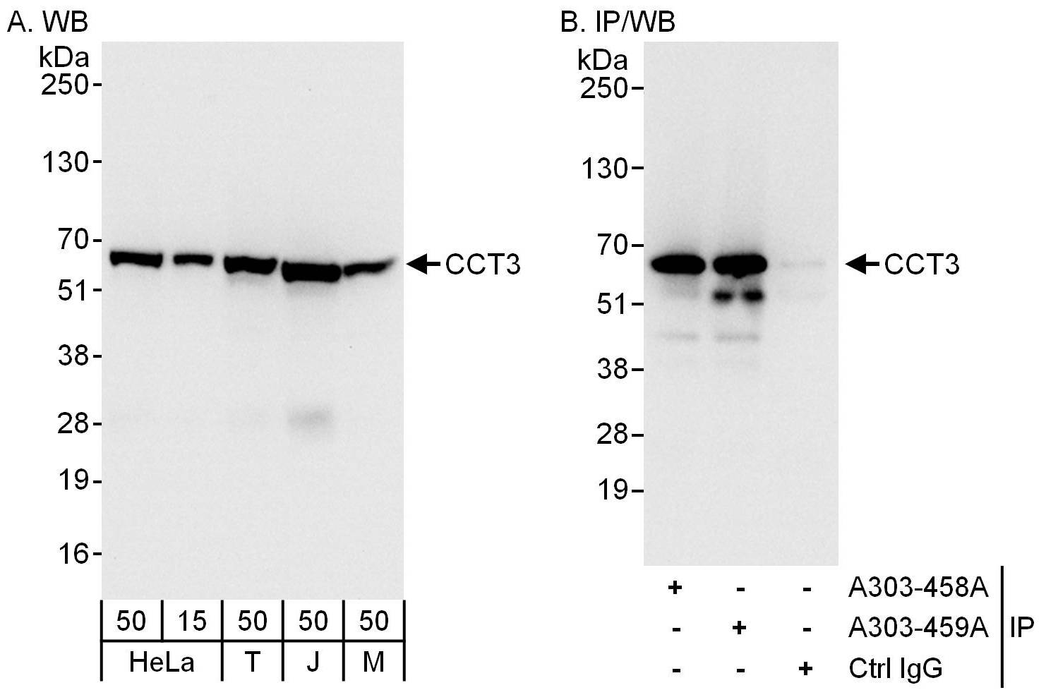 Detection of human and mouse CCT3 by western blot (h and m) and immunoprecipitation (h).