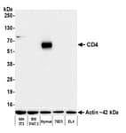 Detection of mouse CD4 by western blot.