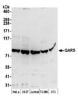 Detection of human and mouse QARS by western blot.