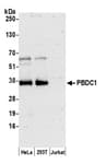 Detection of human PBDC1 by western blot.