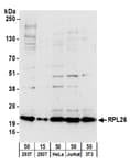 Detection of human and mouse RPL26 by western blot.