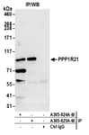 Detection of human PPP1R21 by western blot of immunoprecipitates.
