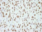 Detection of mouse CA150 by immunohistochemistry.