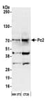 Detection of mouse Pc2 by western blot.