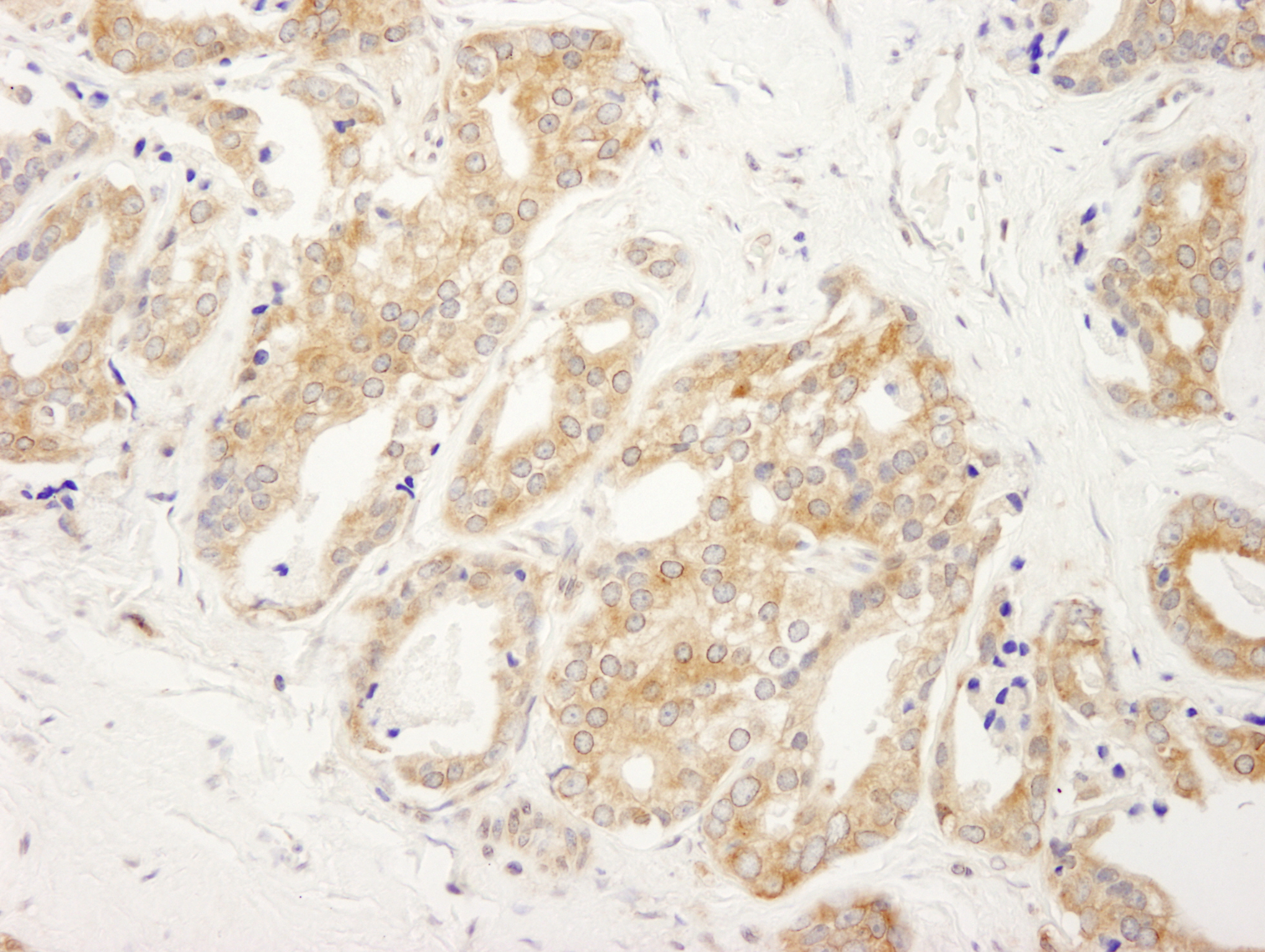 Rabbit anti-DDX6 IHC Antibody