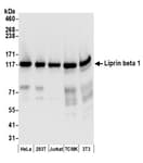 Detection of human and mouse Liprin beta 1 by western blot.