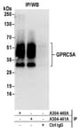 Detection of human GPRC5A by western blot of immunoprecipitates.