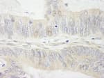 Detection of human MYBBP1a by immunohistochemistry.