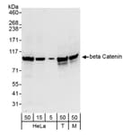 Detection of human and mouse beta Catenin by western blot.