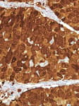 Detection of human AKR1B10 by immunohistochemistry.
